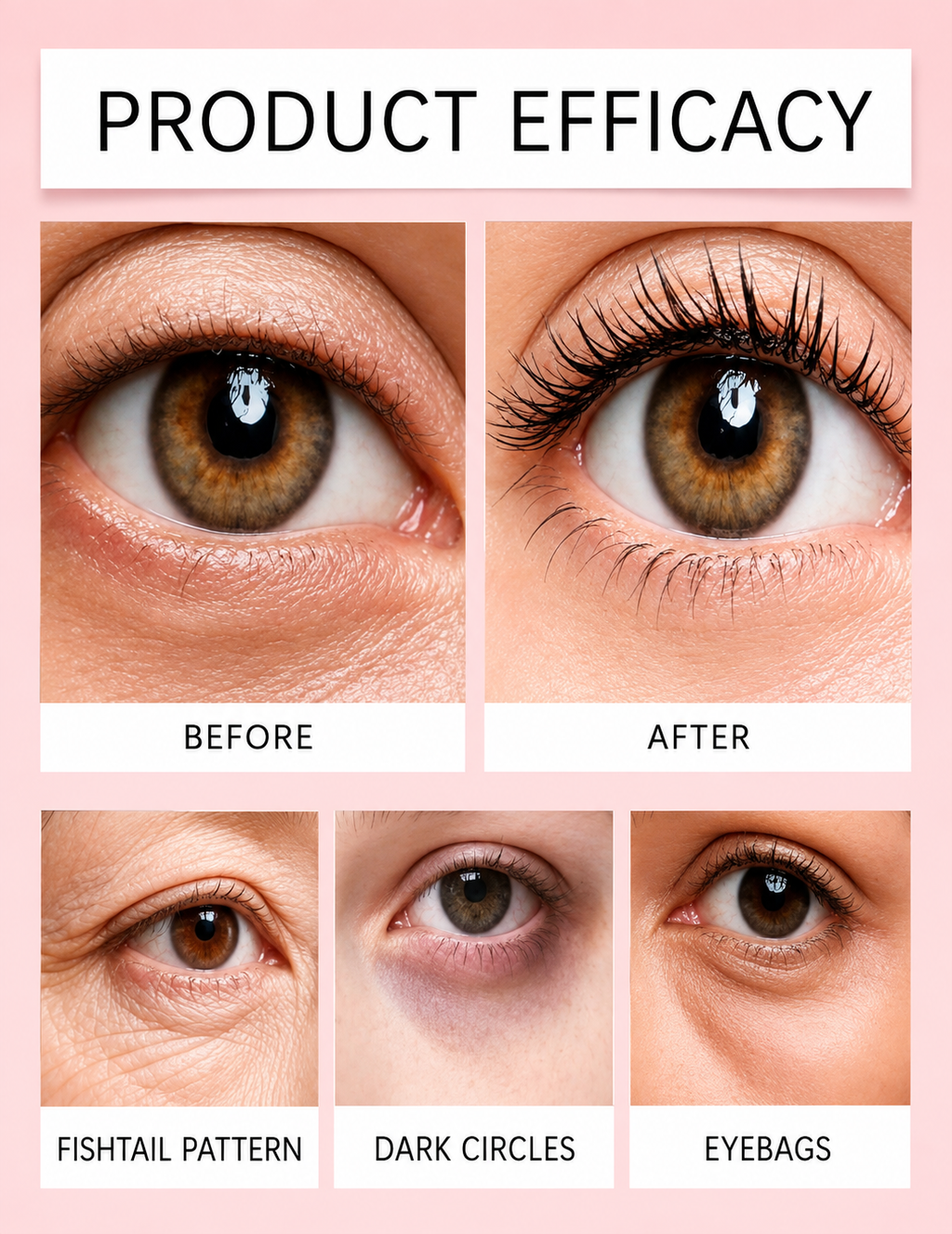 Temporary Eye Tightener