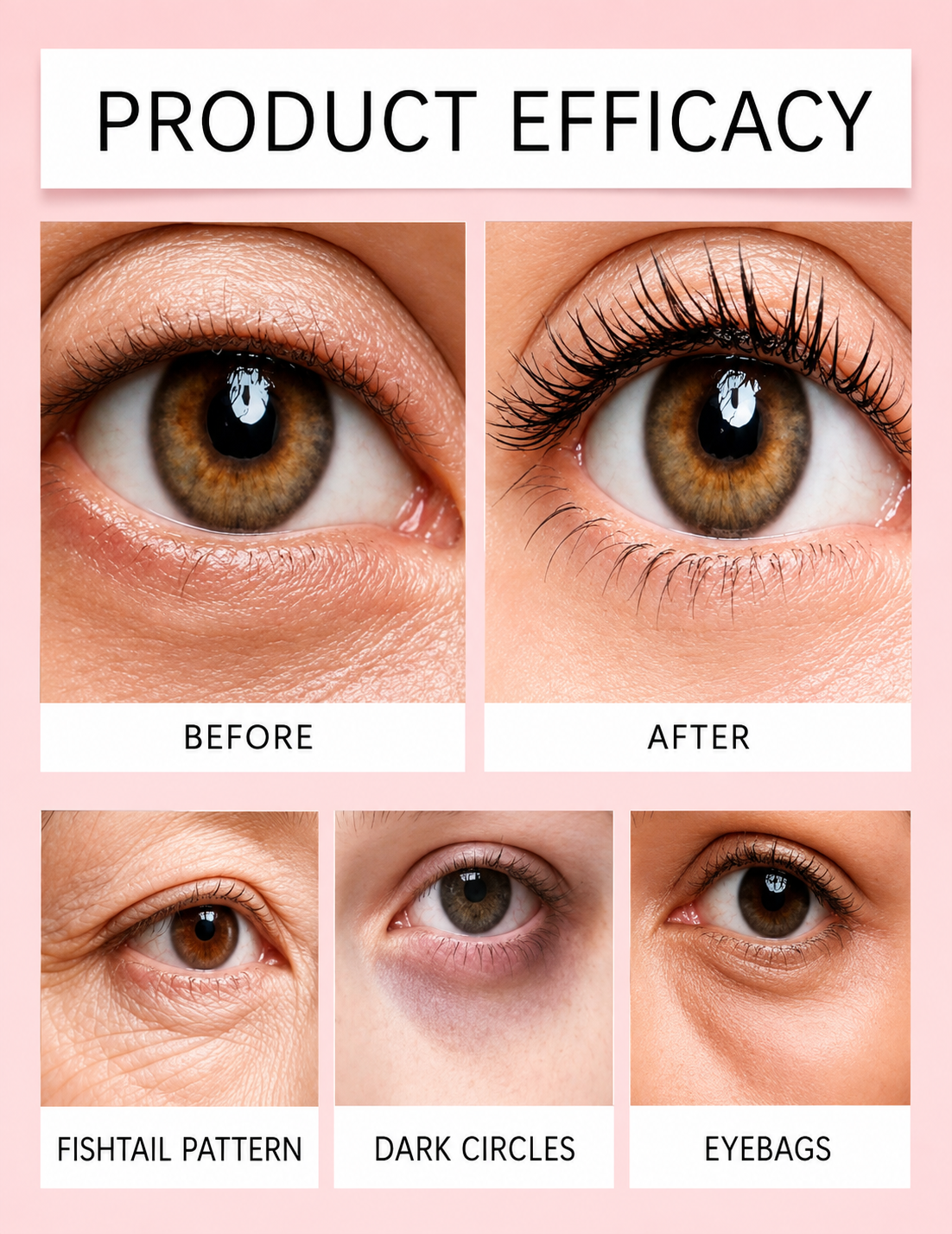 Temporary Eye Tightener